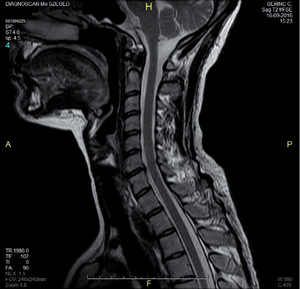 Ágyéki gerinc MR vizsgálata - Medicover Fejlett Diagnosztikai Központ