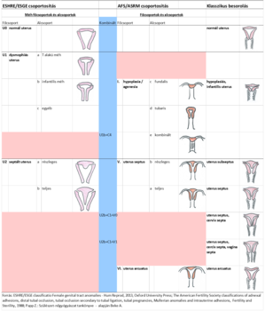 A női genitális traktus anomáliáinak osztályozása ESHRE/ESGE és AFS/ASRM rendszerek szerint.