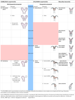 A méh anatómiai variációinak osztályozása ESHRE/ESGE, AFS/ASRM és klasszikus besorolás szerint, diagramokkal.