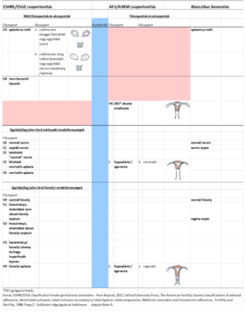 Táblázat a női genitális traktus anomáliáinak osztályozásáról ESHRE/ESGE, AFS/ASRM és klasszikus besorolás szerint.