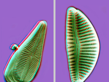 Két különböző diatóma mikroszkópos képe, színes háttérrel.