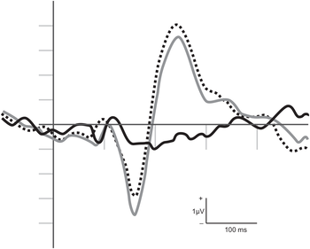 Grafikon különböző vonalstílusokkal, elektromos jelek időbeli változását mutatja, feliratokkal: +, 1μV, -, 100 ms.