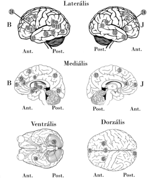 Emberi agy nézetei jelölésekkel Az emberi agy különböző nézetei láthatók, jelölésekkel ellátva: laterális, mediális, ventrális és dorzális.