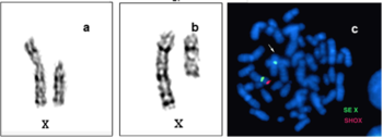 Emberi X kromoszómák különböző megjelenítési módokban Emberi X kromoszómák különböző megjelenítési módokban, fluoreszcens jelöléssel