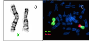 Kromoszóma mikroszkópos képe és fluoreszcens festéssel jelölt Xq és Xp karok.