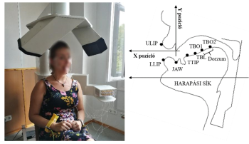 Orvosi eszköz fogászati vizsgálathoz, személy használja, száj anatómiai diagram a pozíciókkal