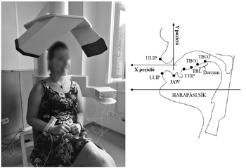 Orvosi vizsgálat szájüreg és harapási sík pozícióival Orvosi vizsgálat, diagnosztikai eszköz alatt ülő személy, szájüreg és harapási sík diagram.